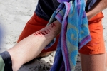 Shark Attack Suspected in Florida