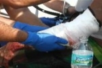 Man Attacked By Shark In New Smyrna Beach