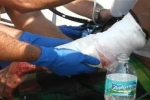 Shark Bite Victim at New Smyrna Inlet (09 16 2011)