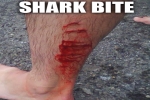 Peter Garrett attacked by a shark off the Taranaki coast