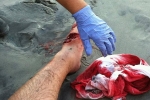 Shark attack at Myrtle Beach