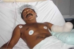 Mexican fisherman loses hand in shark attack