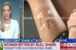 Goald Coast Woman Attacked By Shark After Falling Into River